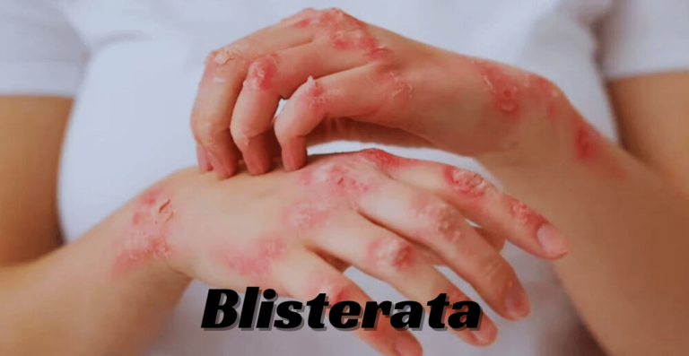 blisterata